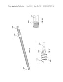 LAGWIRE SYSTEM AND METHOD FOR THE FIXATION OF BONE FRACTURES diagram and image