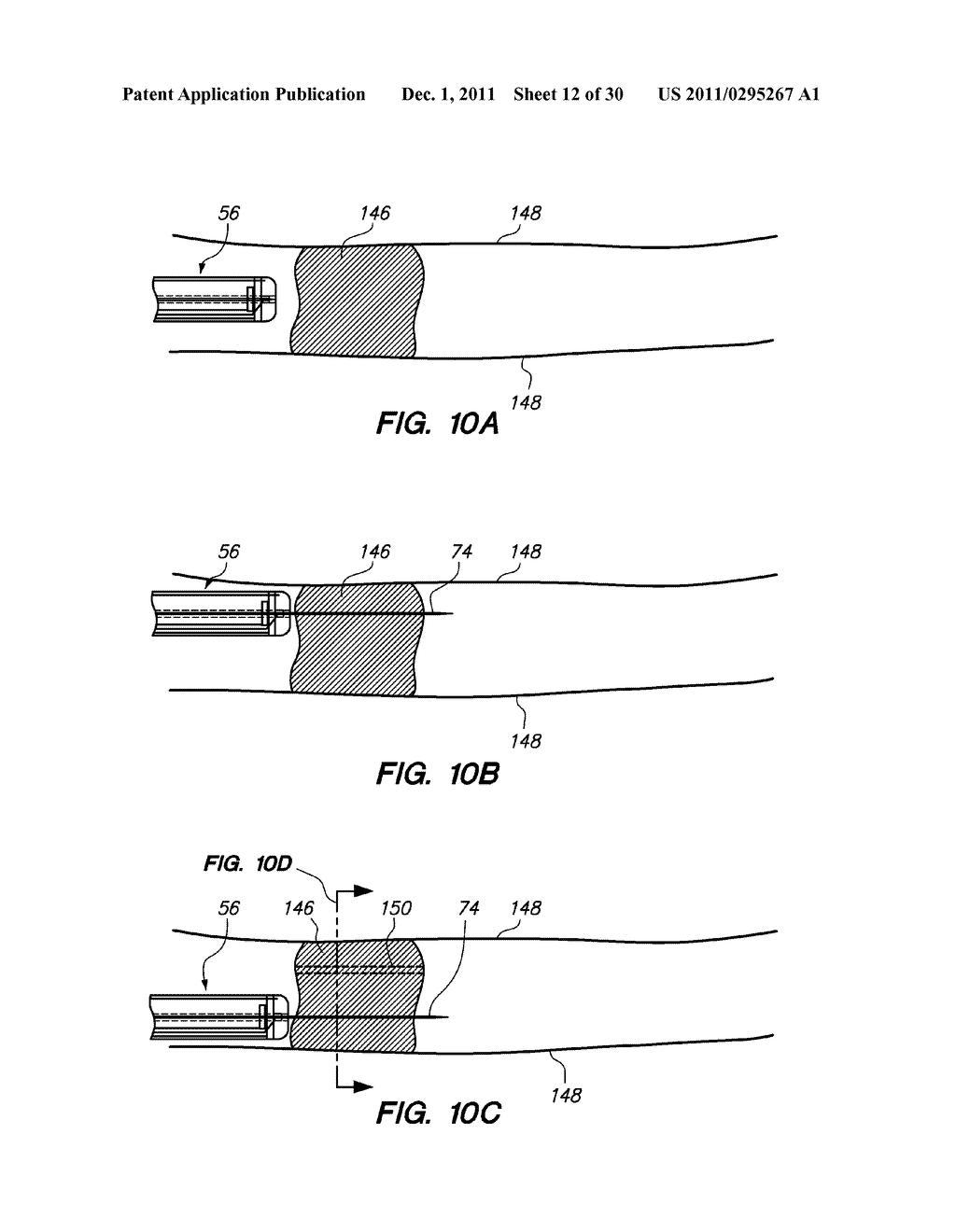 SYSTEM AND METHOD FOR AUTOMATED TISSUE STRUCTURE TRAVERSAL - diagram, schematic, and image 13