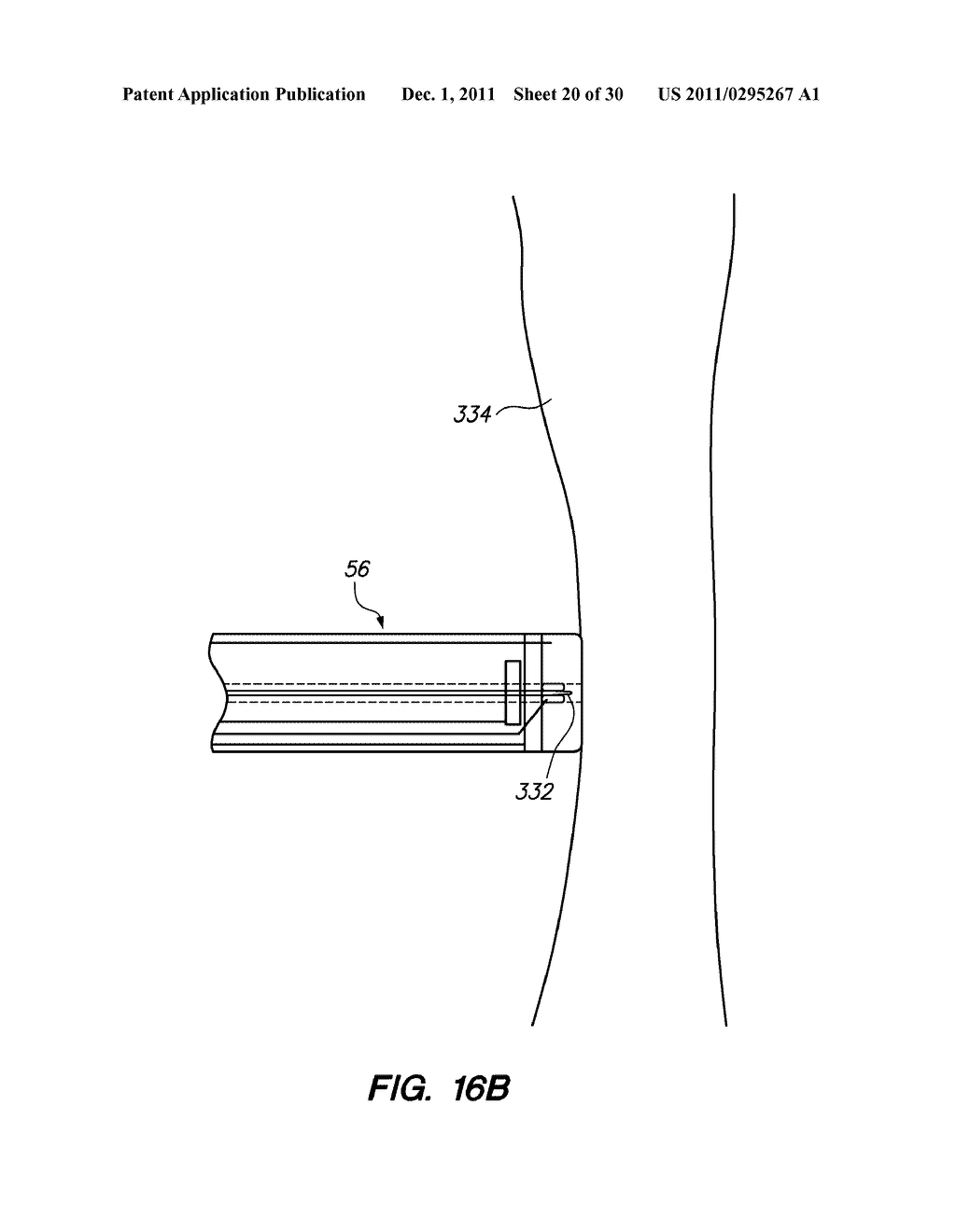 SYSTEM AND METHOD FOR AUTOMATED TISSUE STRUCTURE TRAVERSAL - diagram, schematic, and image 21