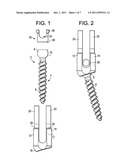 Methods for Correction of Spinal Deformities diagram and image