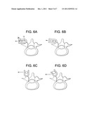 Methods for Correction of Spinal Deformities diagram and image