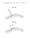 Methods for Correction of Spinal Deformities diagram and image