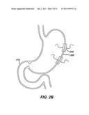 Systems and Methods For Regulating Metabolic Hormone Producing Tissue diagram and image