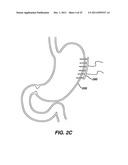 Systems and Methods For Regulating Metabolic Hormone Producing Tissue diagram and image