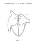 PROSTHESIS FOR RETRIEVAL AND DEPLOYMENT diagram and image