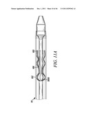 PROSTHESIS FOR RETRIEVAL AND DEPLOYMENT diagram and image