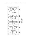 PROSTHESIS FOR RETRIEVAL AND DEPLOYMENT diagram and image