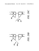 PROSTHESIS FOR RETRIEVAL AND DEPLOYMENT diagram and image