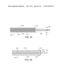 PROSTHESIS FOR RETRIEVAL AND DEPLOYMENT diagram and image