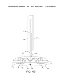 PROSTHESIS FOR RETRIEVAL AND DEPLOYMENT diagram and image