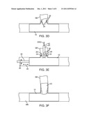 APPARATUS AND METHOD OF USING MARKERS TO POSITION STENTS IN BIFURCATIONS diagram and image