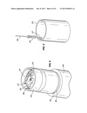 RESISTOR ANODE ASSEMBLY diagram and image