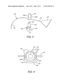 SACROCOLPOPEXY SUPPORT AND METHOD OF IMPLANTATION diagram and image