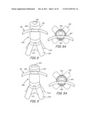 SACROCOLPOPEXY SUPPORT AND METHOD OF IMPLANTATION diagram and image