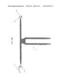 SACROCOLPOPEXY SUPPORT AND METHOD OF IMPLANTATION diagram and image