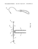 SACROCOLPOPEXY SUPPORT AND METHOD OF IMPLANTATION diagram and image