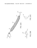 SACROCOLPOPEXY SUPPORT AND METHOD OF IMPLANTATION diagram and image