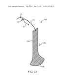 SACROCOLPOPEXY SUPPORT AND METHOD OF IMPLANTATION diagram and image