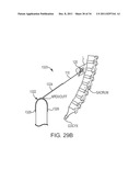 SACROCOLPOPEXY SUPPORT AND METHOD OF IMPLANTATION diagram and image