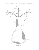 SACROCOLPOPEXY SUPPORT AND METHOD OF IMPLANTATION diagram and image