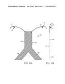 SACROCOLPOPEXY SUPPORT AND METHOD OF IMPLANTATION diagram and image