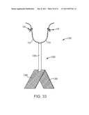 SACROCOLPOPEXY SUPPORT AND METHOD OF IMPLANTATION diagram and image