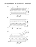 NANOWIRE-BASED TRANSPARENT CONDUCTORS AND APPLICATIONS THEREOF diagram and image