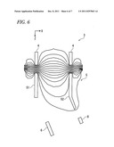 ION IMPLANTING APPARATUS AND DEFLECTING ELECTRODE diagram and image