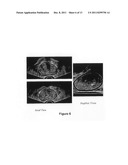 3D TISSUE MODEL FORMATION FROM NON-PARALLEL 2D IMAGES diagram and image