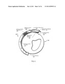 APPLYING A PARTICLE BEAM TO A PATIENT diagram and image