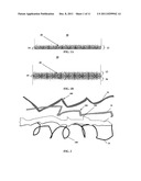 GEOTEXTILE EXCLUSION FABRIC AND METHODS OF USE diagram and image