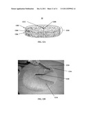 GEOTEXTILE EXCLUSION FABRIC AND METHODS OF USE diagram and image