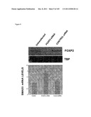 USE OF FOXP2 AS A MARKER FOR ABNORMAL  LYMPHOCYTES AND AS A TARGET FOR     THERAPY OF DISORDERS ASSOCIATED WITH ABNORMAL LYMPHOCYTES diagram and image