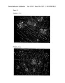 USE OF FOXP2 AS A MARKER FOR ABNORMAL  LYMPHOCYTES AND AS A TARGET FOR     THERAPY OF DISORDERS ASSOCIATED WITH ABNORMAL LYMPHOCYTES diagram and image