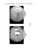 CHIMERIC AND HUMANIZED ANTIBODIES TO ALPHA5BETA1 INTEGRIN THAT MODULATE     ANGIOGENESIS diagram and image