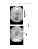 CHIMERIC AND HUMANIZED ANTIBODIES TO ALPHA5BETA1 INTEGRIN THAT MODULATE     ANGIOGENESIS diagram and image