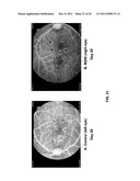 CHIMERIC AND HUMANIZED ANTIBODIES TO ALPHA5BETA1 INTEGRIN THAT MODULATE     ANGIOGENESIS diagram and image