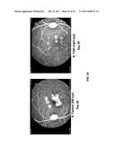 CHIMERIC AND HUMANIZED ANTIBODIES TO ALPHA5BETA1 INTEGRIN THAT MODULATE     ANGIOGENESIS diagram and image