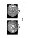 CHIMERIC AND HUMANIZED ANTIBODIES TO ALPHA5BETA1 INTEGRIN THAT MODULATE     ANGIOGENESIS diagram and image