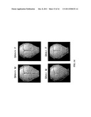 COMPOSITIONS AND METHODS FOR MODULATING CELL-CELL FUSION VIA     INTERMEDIATE-CONDUCTANCE CALCIUM-ACTIVATED POTASSIUM CHANNELS diagram and image