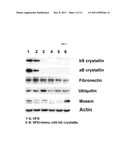 Vaccine Compositions for Inducing Immune Responses Against Components of     Drusen diagram and image