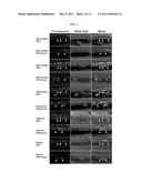 Vaccine Compositions for Inducing Immune Responses Against Components of     Drusen diagram and image