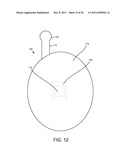 SELF-ADJUSTABLE, SELF-LIGATING ORTHODONTIC BRACKET diagram and image