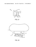 SELF-ADJUSTABLE, SELF-LIGATING ORTHODONTIC BRACKET diagram and image