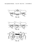 SELF-ADJUSTABLE, SELF-LIGATING ORTHODONTIC BRACKET diagram and image