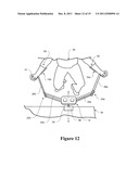 Exercise Device and System diagram and image