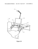 Exercise Device and System diagram and image