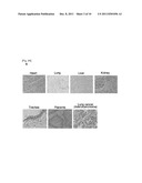 NECTIN-4 FOR TARGET GENES OF CANCER THERAPY AND DIAGNOSIS diagram and image