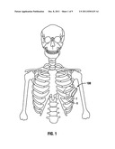 PRESSURE FEEDBACK ACCESS PORTS FOR MINIMALLY INVASIVE SURGERY diagram and image