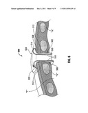 PRESSURE FEEDBACK ACCESS PORTS FOR MINIMALLY INVASIVE SURGERY diagram and image